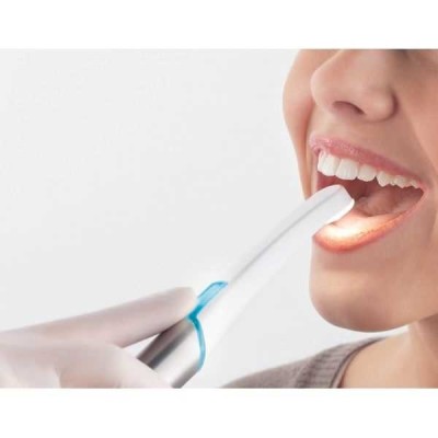 C-U2 - интраоральная камера высокого разрешения C-U2 - интраоральная камера высокого разрешения