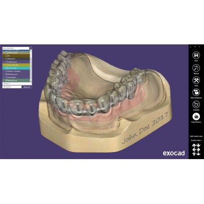 Exocad Bar Module - модуль для создания балочных конструкций Exocad Bar Module - модуль для создания балочных конструкций
