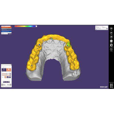 Exocad Bite Splint Module - модуль для создания терапевтических капп Exocad Bite Splint Module - модуль для создания терапевтических капп