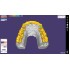 Exocad Bite Splint Module - модуль для создания терапевтических капп Exocad Bite Splint Module - модуль для создания терапевтических капп