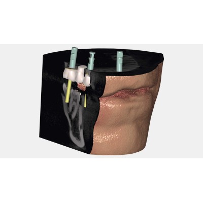 Exocad DICOM viewer - средство просмотра DICOM файлов Exocad DICOM viewer - средство просмотра DICOM файлов