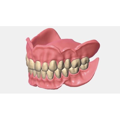 Exocad Full Denture Module - модуль для создания полносъемных протезов Exocad Full Denture Module - модуль для создания полносъемных протезов