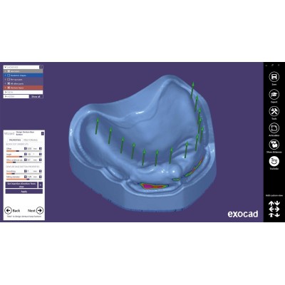 Exocad Full Denture Module - модуль для создания полносъемных протезов Exocad Full Denture Module - модуль для создания полносъемных протезов