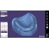 Exocad Full Denture Module - модуль для создания полносъемных протезов Exocad Full Denture Module - модуль для создания полносъемных протезов