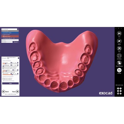 Exocad Full Denture Module - модуль для создания полносъемных протезов Exocad Full Denture Module - модуль для создания полносъемных протезов