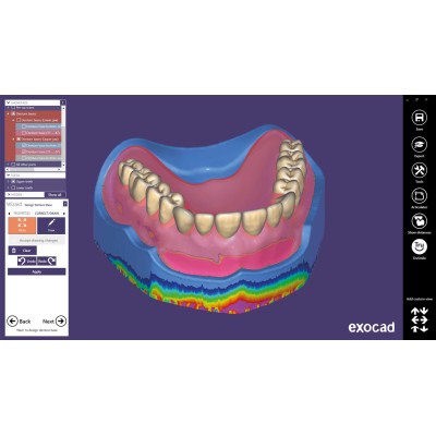 Exocad Full Denture Module - модуль для создания полносъемных протезов Exocad Full Denture Module - модуль для создания полносъемных протезов
