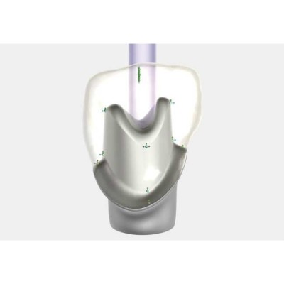 Exocad Implant Module - модуль для создания имплантов Exocad Implant Module - модуль для создания имплантов