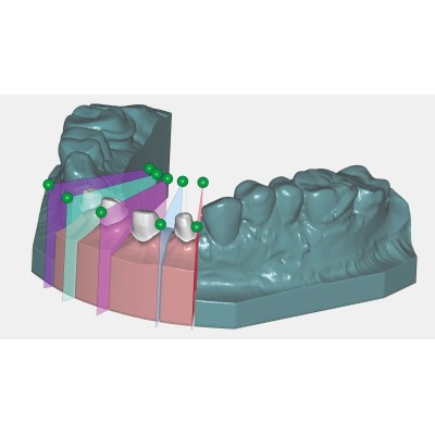 Exocad Model Creator - модуль для создания моделей Exocad Model Creator - модуль для создания моделей