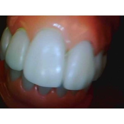 Whicam VI - беспроводная интраоральная камера, комплектация VI Whicam VI - беспроводная интраоральная камера, комплектация VI