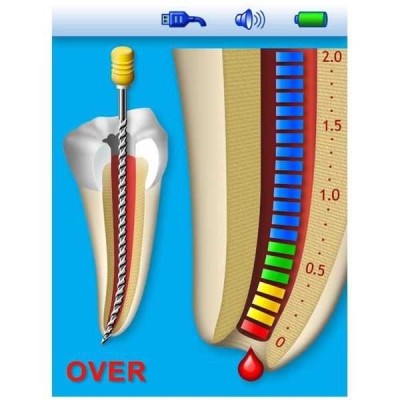 Апекслокатор Bingo Pro полностью автоматический с функцией виртуального апекса Апекслокатор Bingo Pro полностью автоматический с функцией виртуального апекса