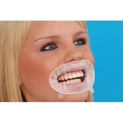 Ретракторы для губ OptraGate, 80шт Ретракторы для губ OptraGate, 80шт