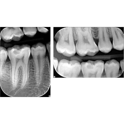 KaVo FOCUS - настенный дентальный рентгеновский аппарат KaVo FOCUS - настенный дентальный рентгеновский аппарат