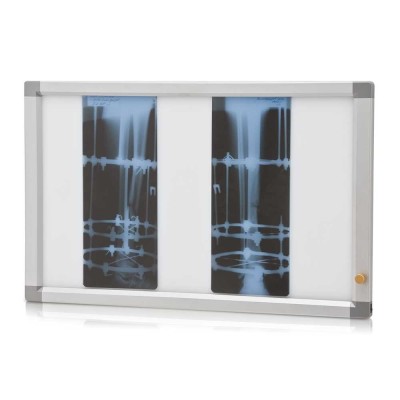 Негатоскоп флуоресцентный двухкадровый Негатоскоп флуоресцентный двухкадровый