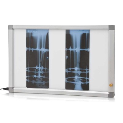 Негатоскоп флуоресцентный двухкадровый Негатоскоп флуоресцентный двухкадровый