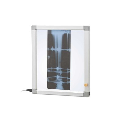 Негатоскоп флуоресцентный однокадровый Негатоскоп флуоресцентный однокадровый