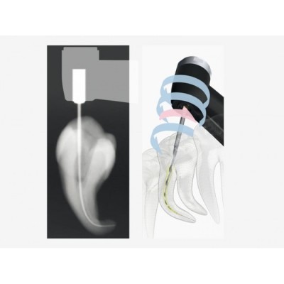 Tri Auto ZX2 - беспроводной эндодонтический мотор со встроенным апекслокатором Tri Auto ZX2 - беспроводной эндодонтический мотор со встроенным апекслокатором